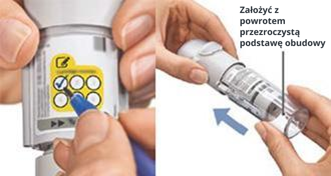 Zaznaczenie liczby użytych wkładów