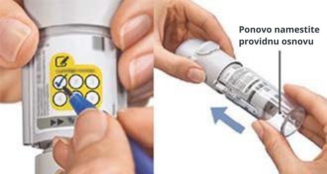 Evidentiranje broja korišćenih uložaka